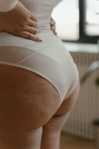 A close-up of a woman's lower back with cellulite