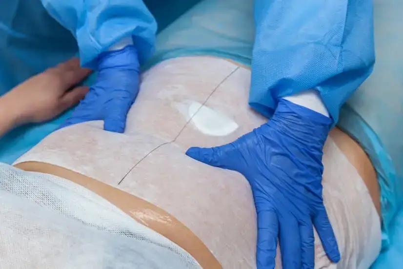 Clinical Non-Invasive Body Contouring