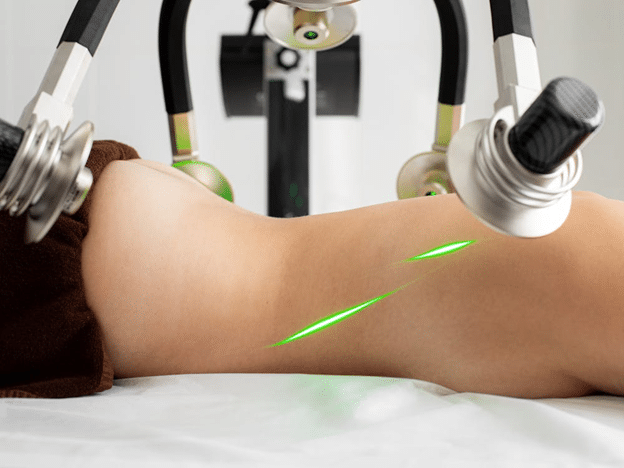 topless woman lying upside down getting body contouring done